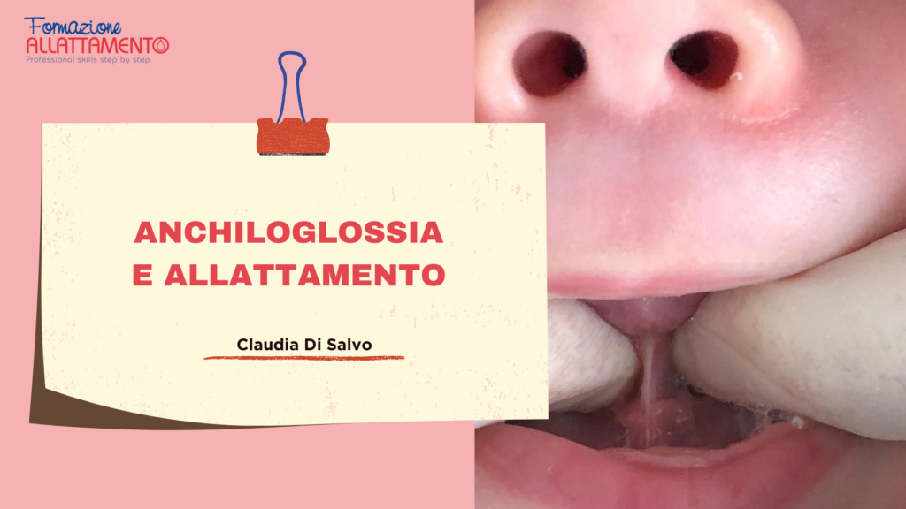 anchiloglossia e allattamento