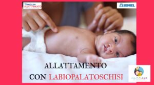 corso labiopalatoschisi